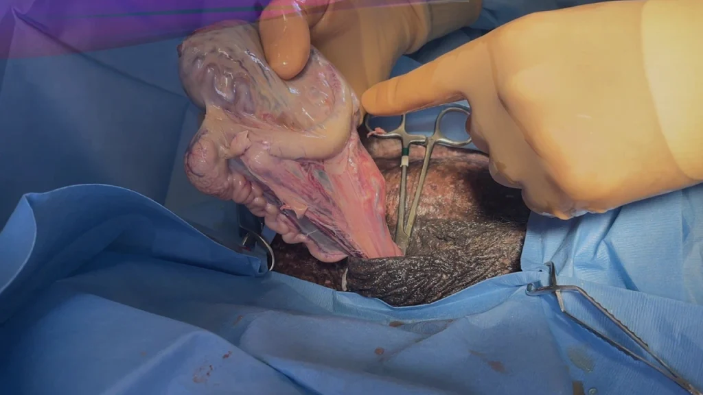 Half-closed castration_hospital_cover_no words (1)